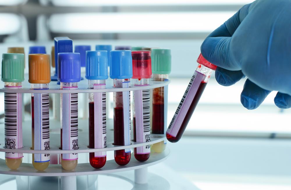 Adjunctive Cancer Support Therapies