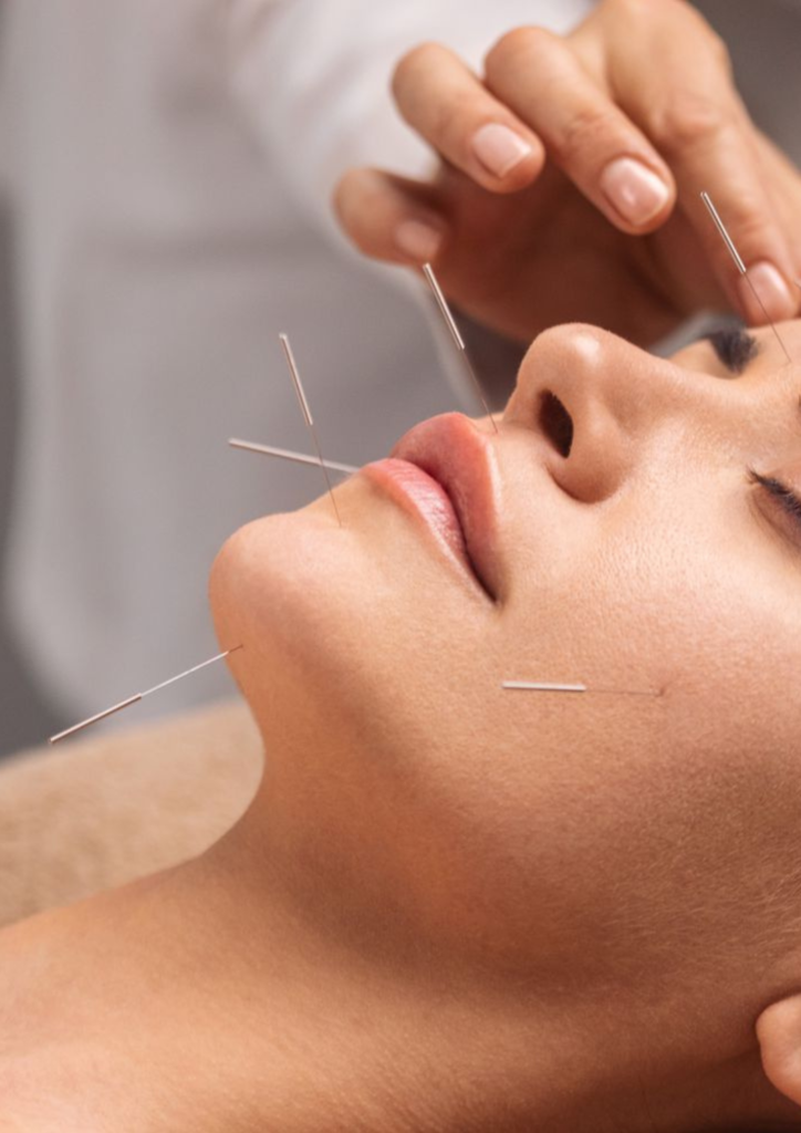 Acupuncture facial